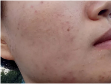 QQ截图20180308113418.png