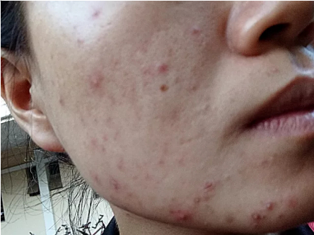 QQ截图20180308113347.png