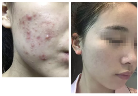 QQ截图20180709113241.png
