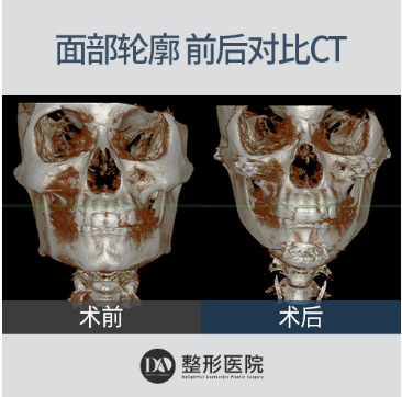 QQ截图20180723141741.png