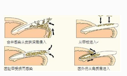 33.png