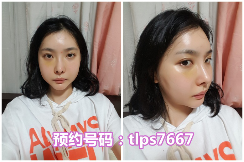 1566198662454756.png
