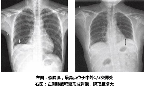图片32.png